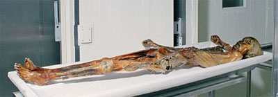 Ötzi