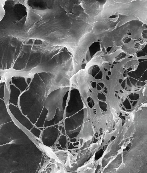 Extracellular Matrix
